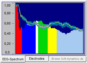 Neurofeedback - eBioo Koh�renz